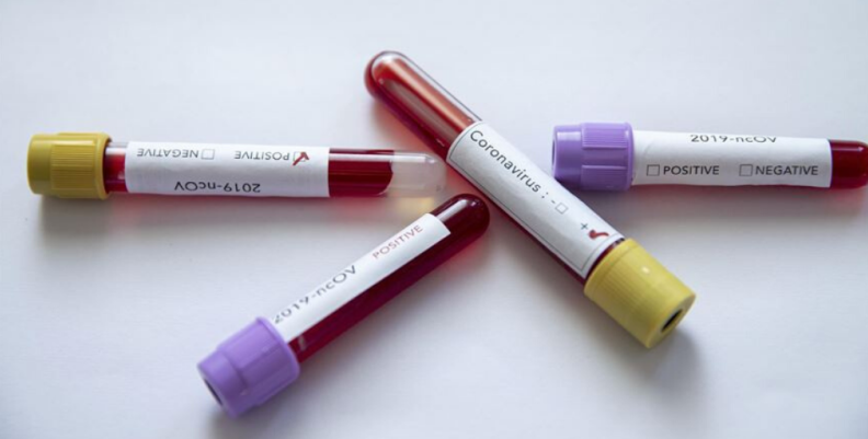 Casos coronavirus Casos coronavirus