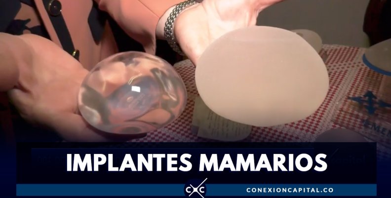 En Colombia, hay más de 900 reportes por problemas relacionados con implantes mamarios