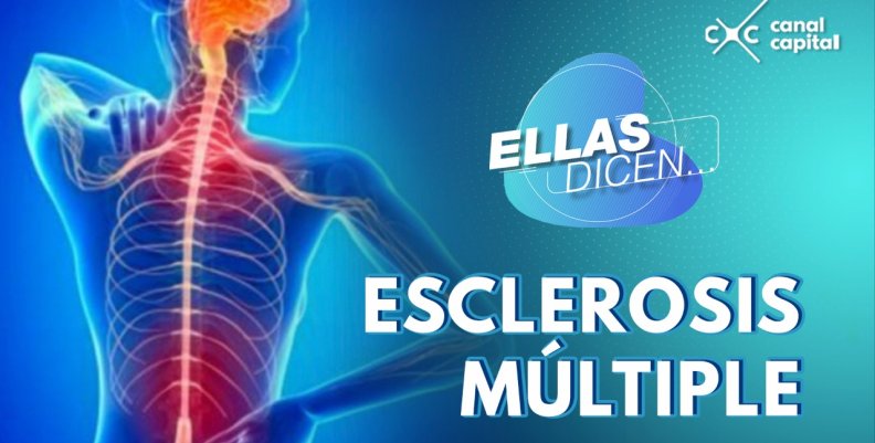 esclerosis-multiple