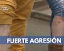 fuerte-agresión-pitbull