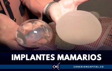 En Colombia, hay más de 900 reportes por problemas relacionados con implantes mamarios