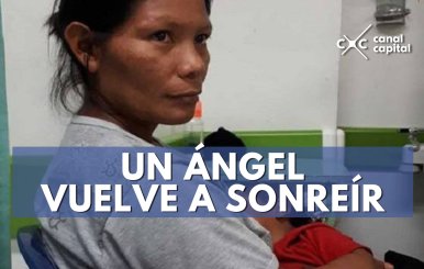 Hospital Simón Bolívar interviene a niño indígena con labio leporino