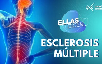 esclerosis-multiple