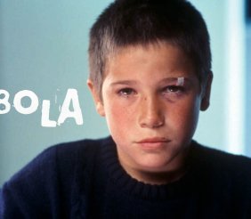 Niño con la cara lastimada mirando a cámara con un fondo azul